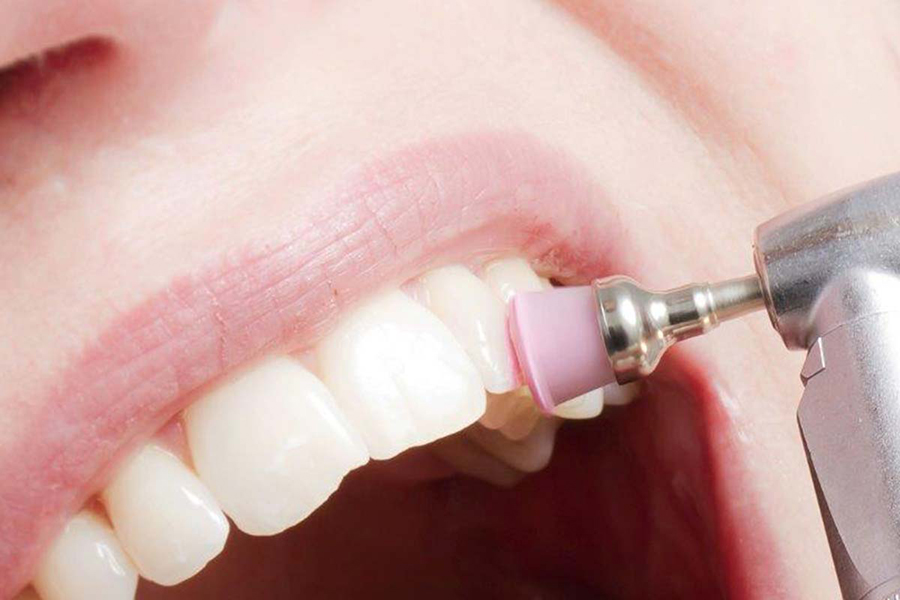 Pulizia dentale, più che un trattamento