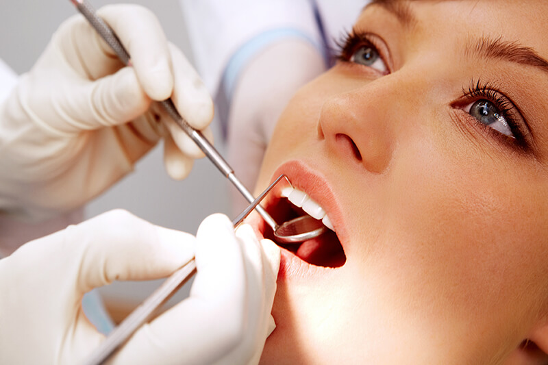  Pulizia dentale professionale 